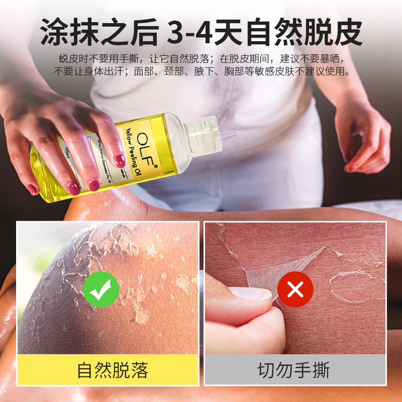 Aceite de peeling amarillo transfronterizo