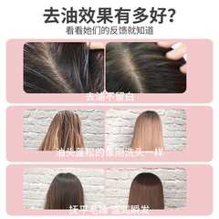 Airy no-wash fluffy spray dry hair spray oil removal and oil control artifact dry and refreshing source factory wholesale delivery