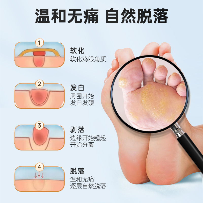 Nanjing Tongrentang Lejia Old Shop Corns Patch Corns Ointment Flesh Pricks Calluses Foot Care Corns Plaster