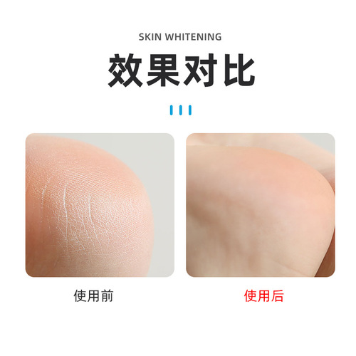 Silicone Heel Protector Relief Heel Cover Foot Protector Women's Socks Heel Wear-Resistant Cover Moisturizing Socks Wholesale