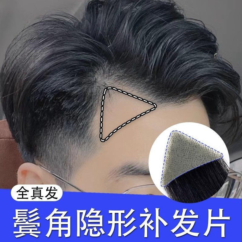Wig with Fake Bangs and Hairline, Real Human Hair Hairpiece for Sideburns, Full Head Biological Scalp Scar Cover