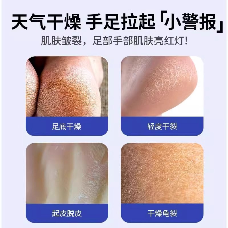 日本皴裂膏脚后跟干裂滋润保湿防裂膏手足皲裂膏凝露护手霜叮叮|undefined