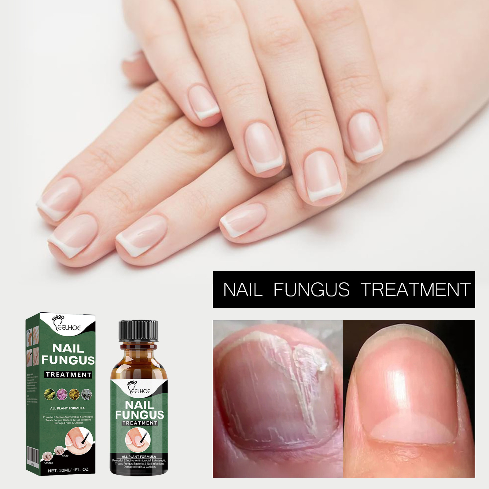 Eelhoe Nail Care Solution Hand and Foot Nail Cleaning Mild Ingredients Daily Maintenance Care Solution