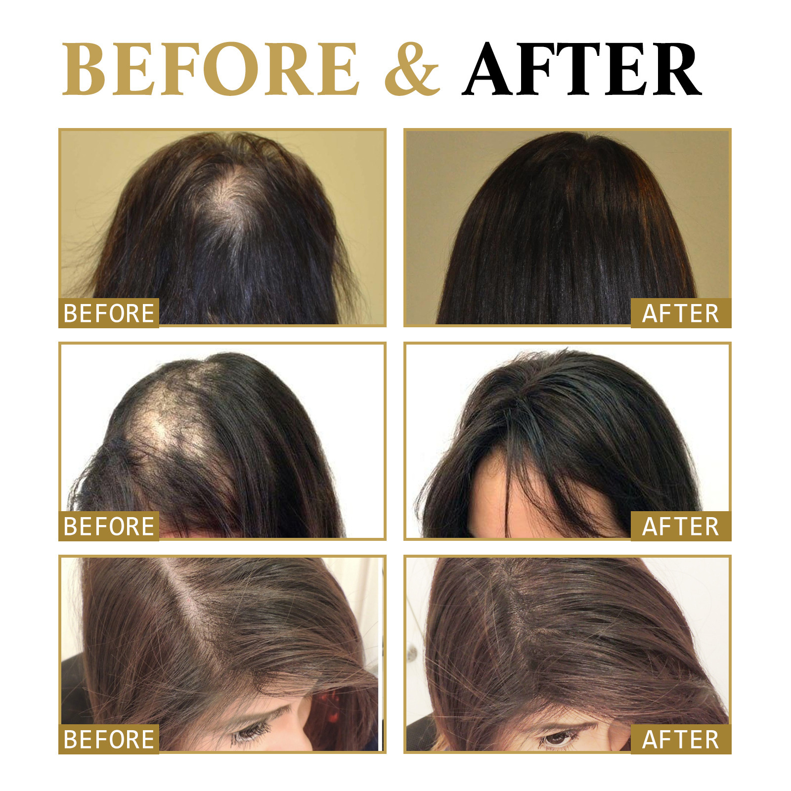 Masaje OUHOE Ginseng Cuero cabelludo hidratante, cabello fuerte, reafirmante, cuidado antipérdida, esencia de cabello denso_voghion.com