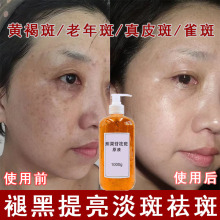 熊果苷原液淡改善暗黄提亮美肤焕白淡化黄褐斑溶斑精华液院装批发