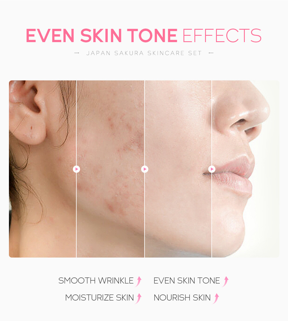 LAIKOU Sakura Skincare Set Image 5