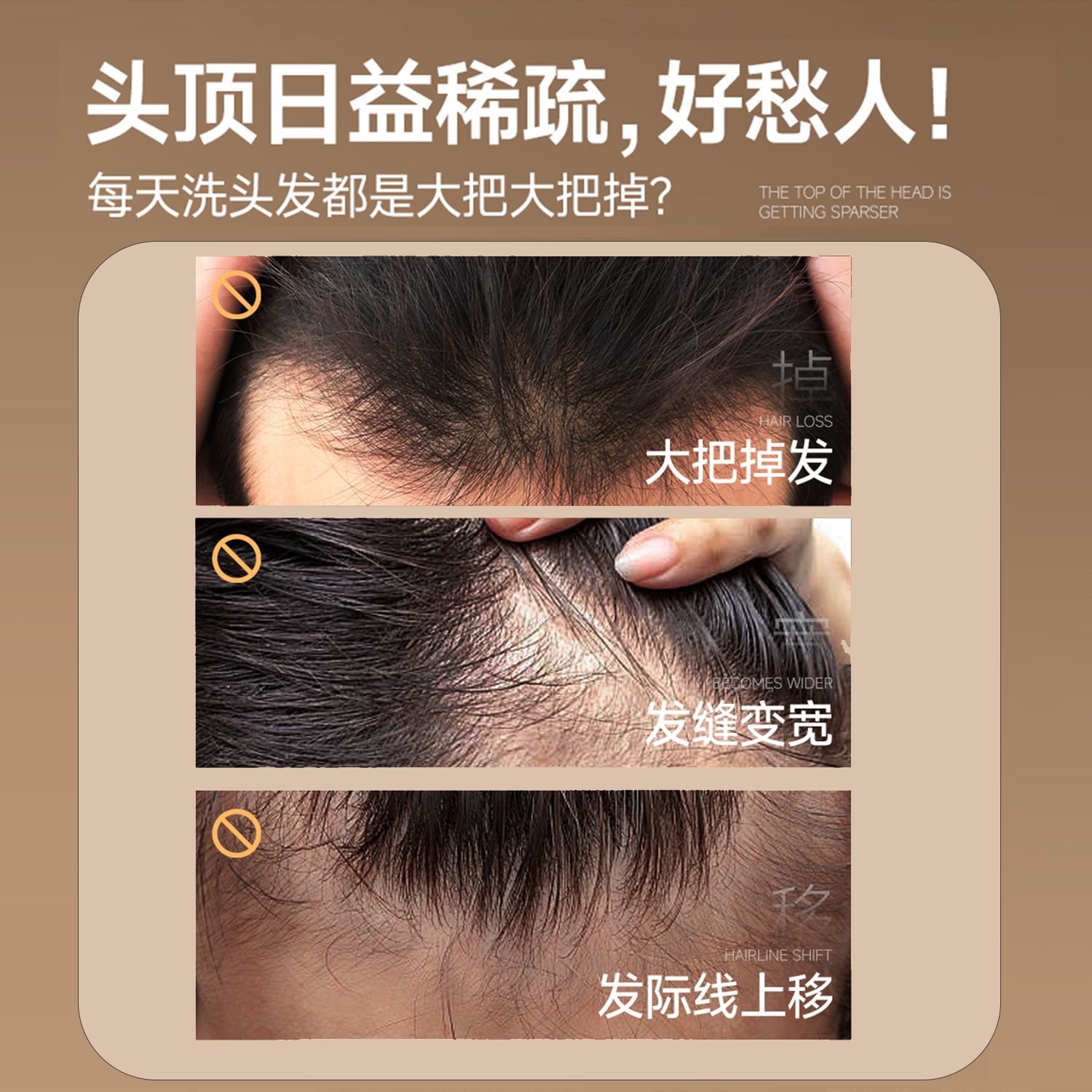 Natural Story anti-alopecia, champú de cabello sólido para hombres, control de aceite, limpieza, anti-alopecia, fabricación de perfume de larga duración