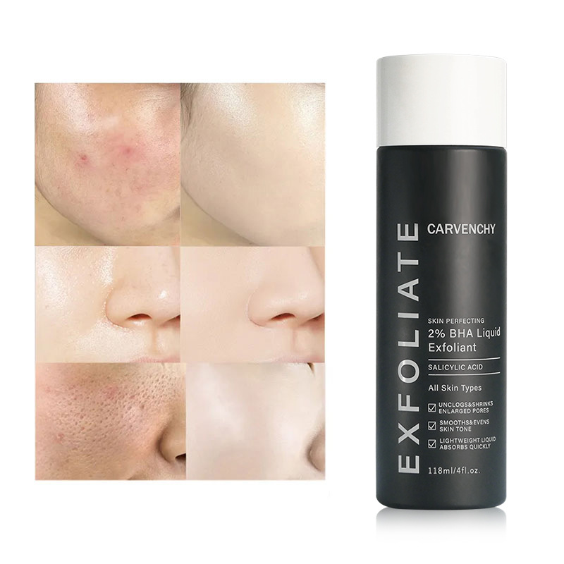 Cross -border dedicated to 2% BHA liquid exfolian hydrating…