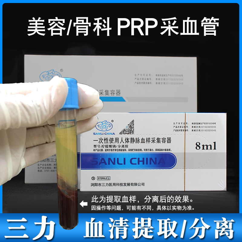 Sanli Prp Beauty Tube Serum Separation Blood Collection Tube Prp Extraction Platelet Plasma Separation Test Tube 8ml Sanli Prp Beauty Tube Serum Separation Blood Collection Tube Prp Extraction Platelet Plasma Separation Test Tube 8ml