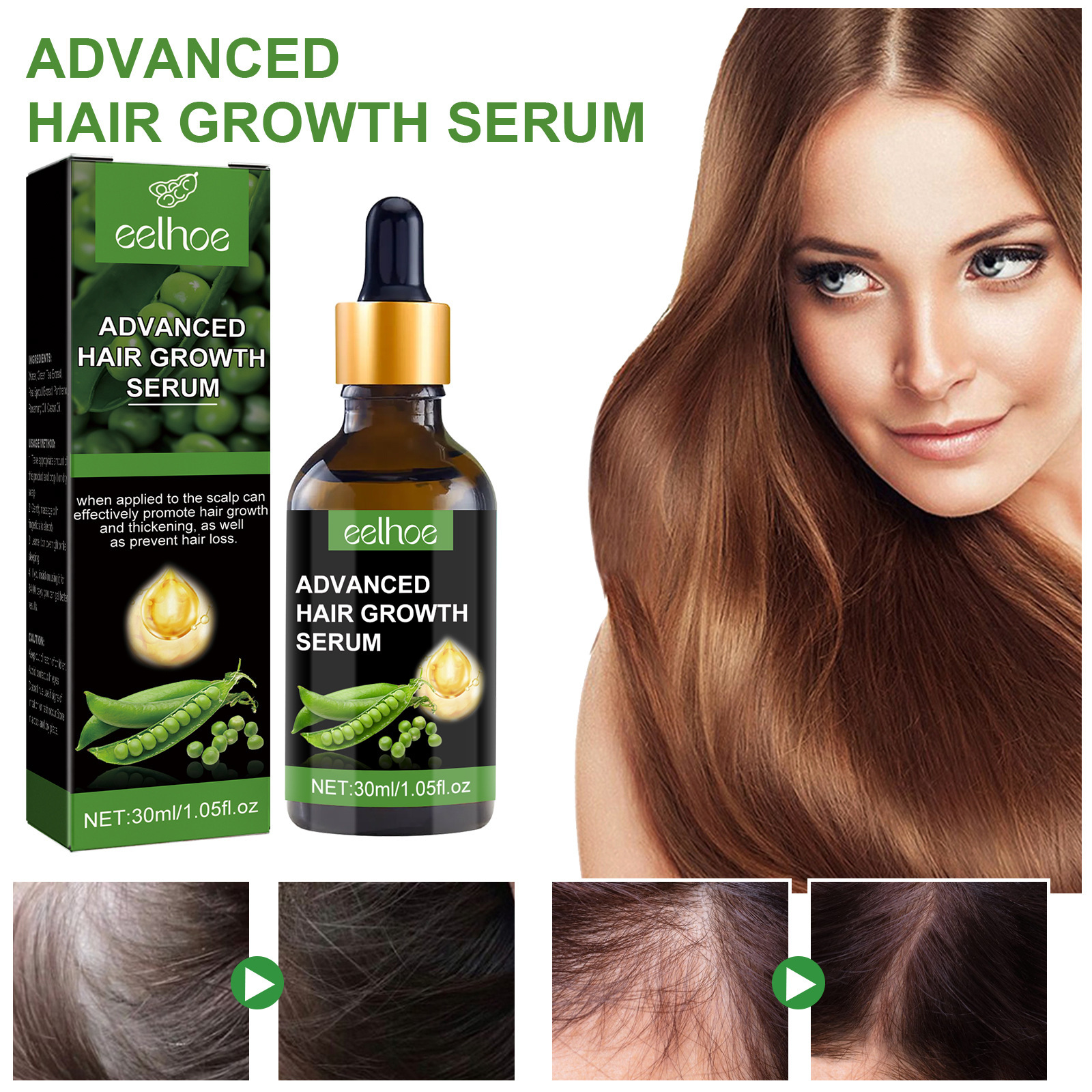 EELHOE Hair Essence Spendet Feuchtigkeit für die Haarwurzeln, pflegt die Kopfhaut, sorgt für kräftiges Haar, beugt Haarausfall vor und verdickt das Haar_voghion.com