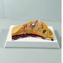 生产人体解剖乳房病变模型 乳房解剖模型 乳腺管解剖 房病理模型