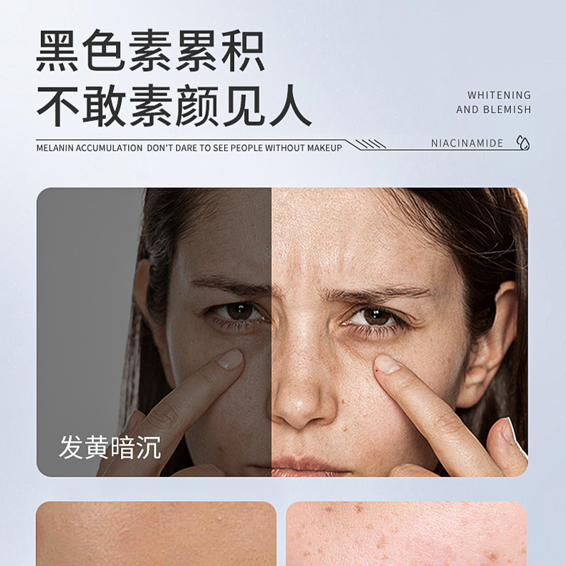 377 美白、シミ、若返り美容液、肌を明るくする、黄ばみを取り除く、セカンドパルス美容液、保湿美容液|undefined