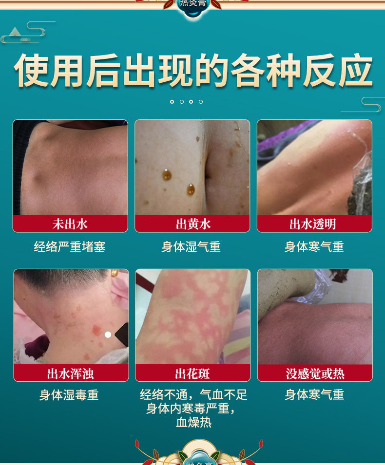 Herbal Heat Therapy Moxibustion Paste 700g Warming Topical Body Paste for Shoulder and Full Body Massage Use in use