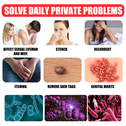 South Moon Pinghou Youke Wart Cream, Wart Cream, Hands, Feet, Face, Armpits, Neck, Filamentary Suppression of Warts