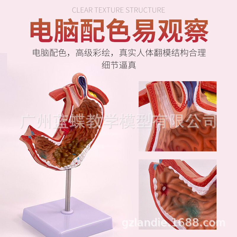 ����θģ�� ����θ�Ĵ��� ��̬θģ�� ������ θ��״������ʷŴ�