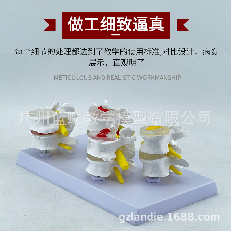 �Ľ׶β�����׵ģ�� ��������ģ�� ���ι��� ��̬������׵ģ��