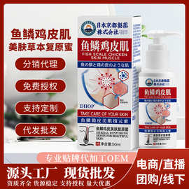 鱼鳞鸡皮肌美肤复原蜜 oem全身鸡皮肤疙瘩缓解干燥保湿美肤身体乳