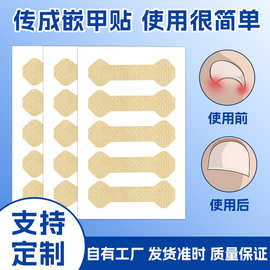 跨境热卖正甲贴指甲扎肉矫正贴脚趾嵌甲贴改善甲沟内卷指甲正甲贴
