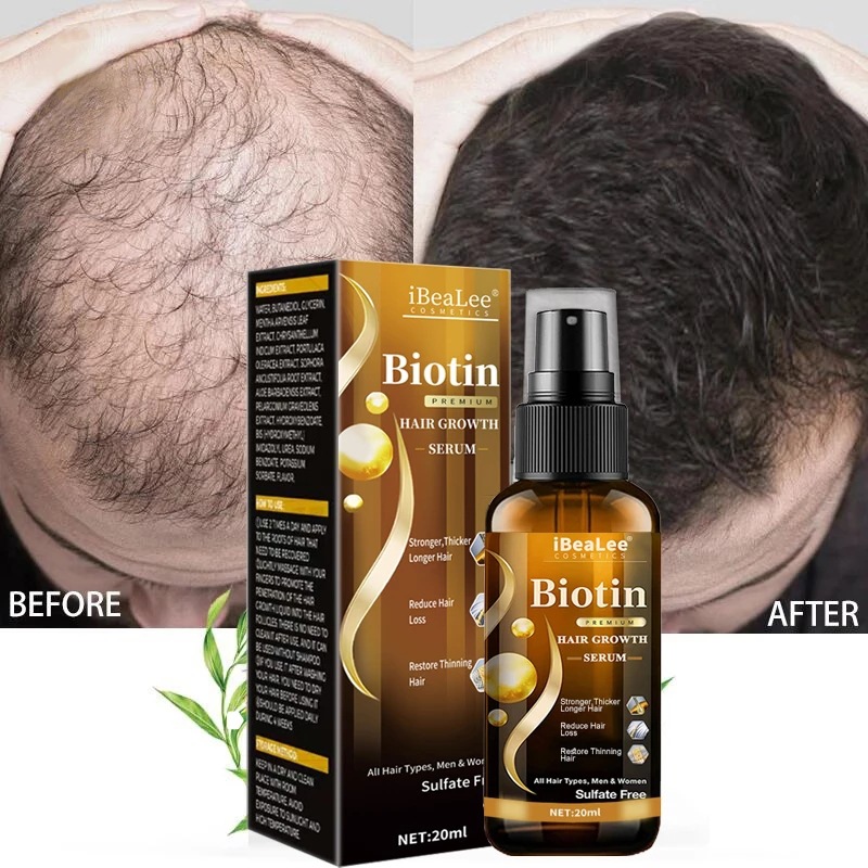 iBeaLee头发护理液 强韧秀发营养防掉滋润发根浓密头皮按摩营养
