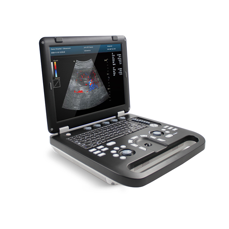 Kantai veterinario instrumento de diagnóstico de ultrasonido de imagen de ultrasonido de color animal portátil máquina de ultrasonido de color b fabricante