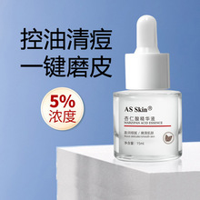 5%�����ᾫ�AҺ �嶻ȥ���^�]�ڷ۴̿����տsë�� �ͺ������ԭҺ