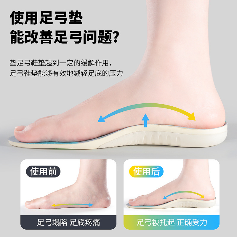 Soporte de arco para pies planos, ortopedia de valgus de piernas tipo x para adultos, almohadilla de arco para hombres y mujeres