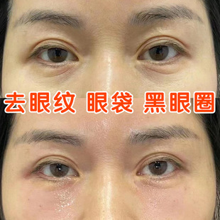 Aidiben Eye Cream Anti-Wrinkle Reduces Fine Lines, Removes Eye Bags, Dark Circles, Crow's Feet, Anti-Wrinkle Firming Eye Cream