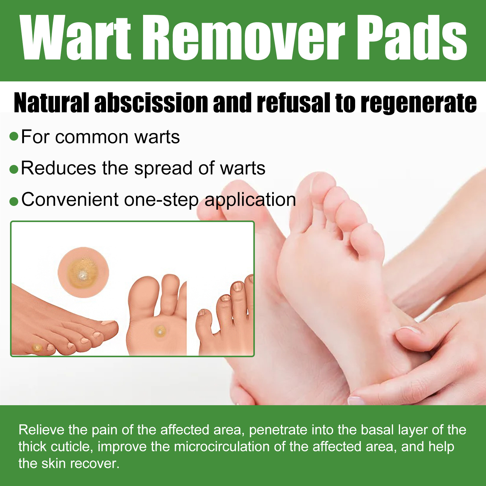 EELHOE lamedad niitjad tüükad kätel ja jalgadel, kanasilma kallused, tüügaste eemaldamise plaaster keha puhastamiseks ja hooldamiseks_voghion.com