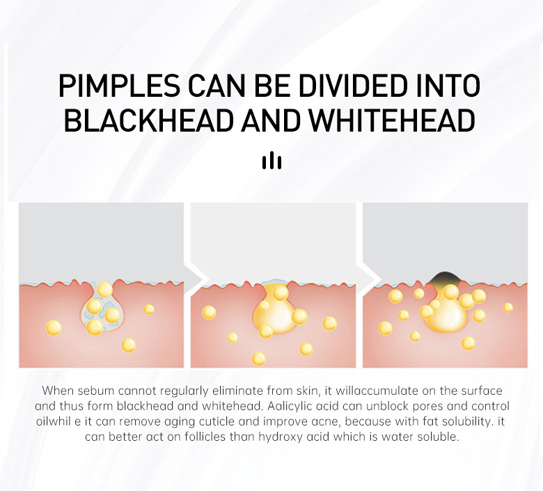 Salicylic Acid Repair Lotion