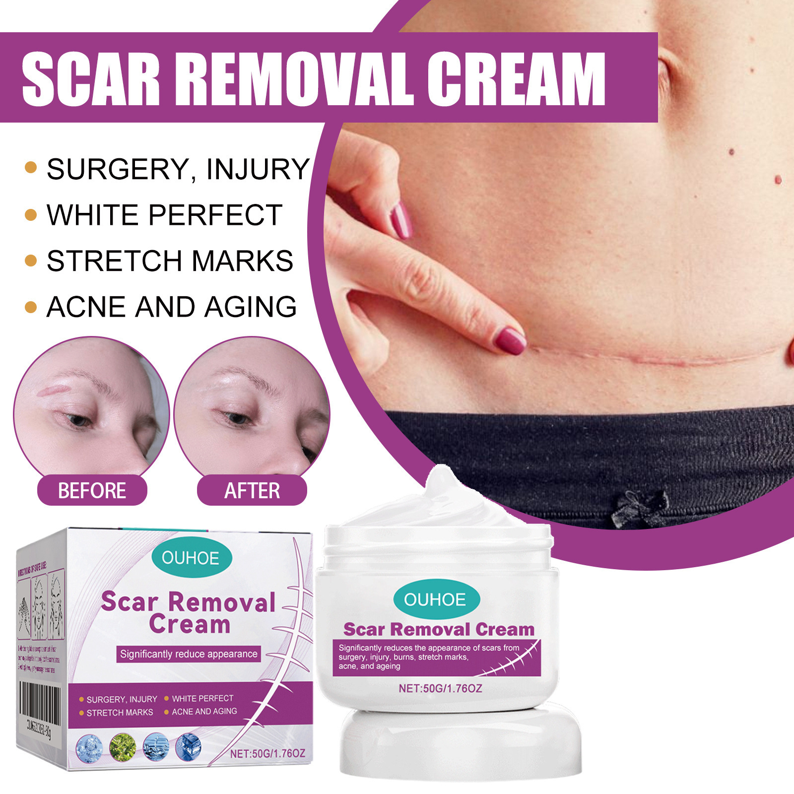 Ouhoe Skin Care Cream Gentle Nourishing and Moisturizing Body Skin Daily Care Face and Body Care Cream