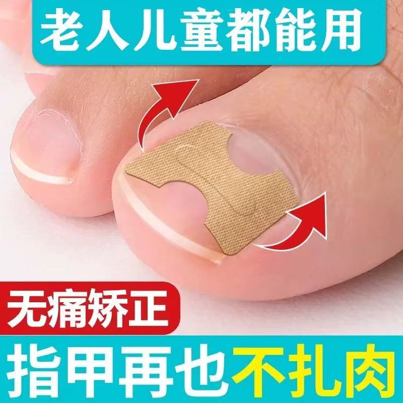 Cross-Border Correction Artifact, Special Nail Patch for Long Toenails in the Flesh, Nail Groove Ingrown Nail Corrector, Toenail Tool