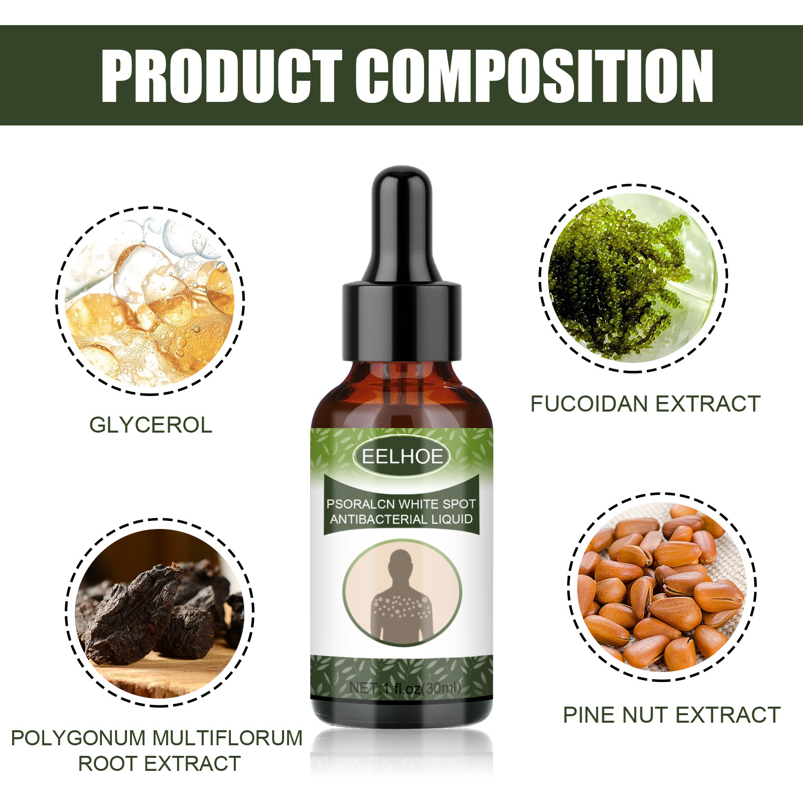 EELHOE Entferner Haut Leukoplakie Schweißfleckennetz Außenpflege Psoralen Essenz_voghion.com