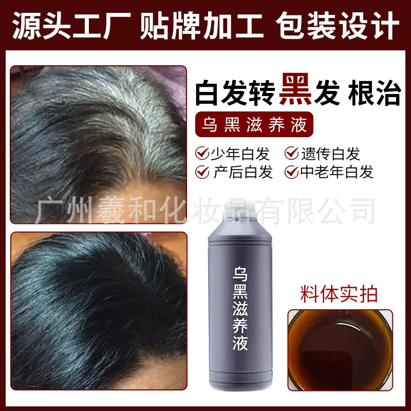 白转黑精华液生发液滋养发根白发转黑发院线白发养黑发原液育发液