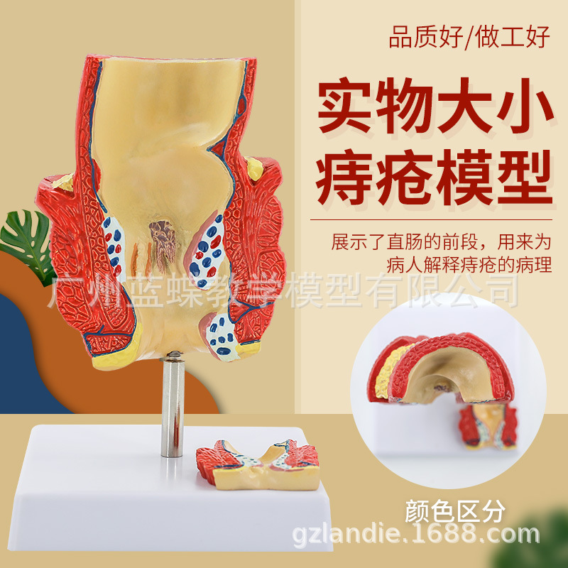 ֱ���̴�����ģ�� �̴�������� ���Ÿس��� ��ֱ������ģ��