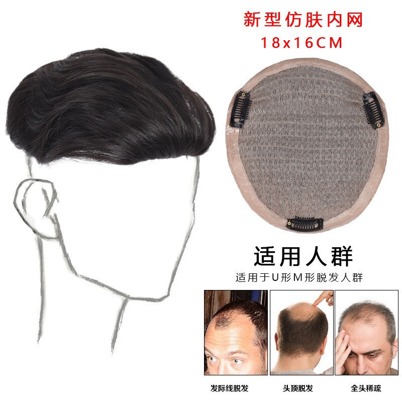 男性のかつらがかっこいい背中に髪を補充する自然な目に見えない自然なシミュレーション頭上増発量の頭上カバー|undefined