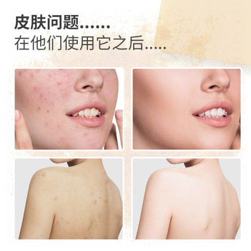 Cross-border Turmeric Papaya Cleansing Soap Goat Milk Handmade Soap 110g Deep Cleansing Moisturizing Soap Bath Goat Milk Soap