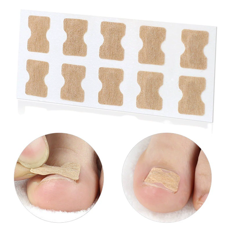Наклейки для коррекции ногтей от производителя, безклеевые наклейки для коррекции ногтей на ногах, наклейки для восстановления ногтей, наклейки для коррекции ногтевых пазов