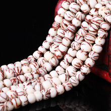 ����ʮ����18�Ӷ���Ѫ�z�������ɢ������ִ�Ͱ��DIY����朲���