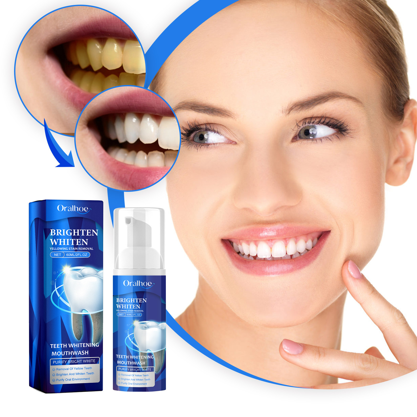 Brightening Whitening Mousse Tooth Cleansing for Yellow Dental Stains, Beautifying Teeth and Refreshing Breath_voghion.com