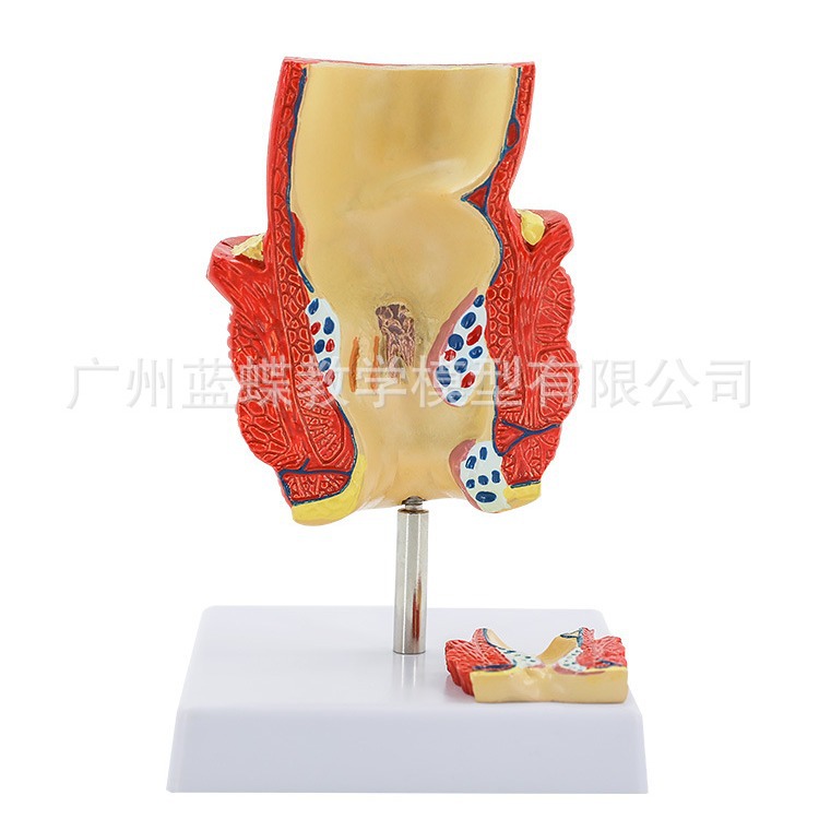 ֱ���̴�����ģ�� �̴�������� ���Ÿس��� ��ֱ������ģ��