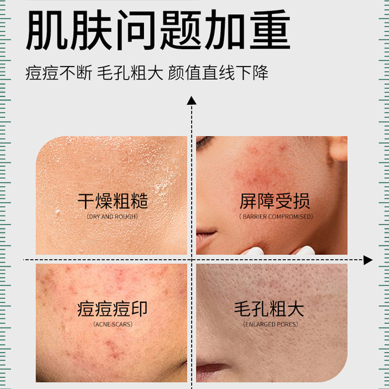 美容院のオフラインタイプのオリゴペプチド冷凍乾燥粉ポリペプチドは8万の活性を緩和して修復します。|undefined