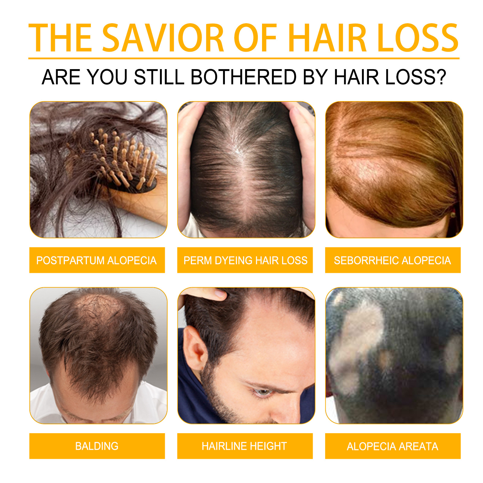 Monat ist West stark, robust, repariert geschädigtes Haar, beugt Haarausfall vor und schützt das Haar mit ätherischem Öl_voghion.com