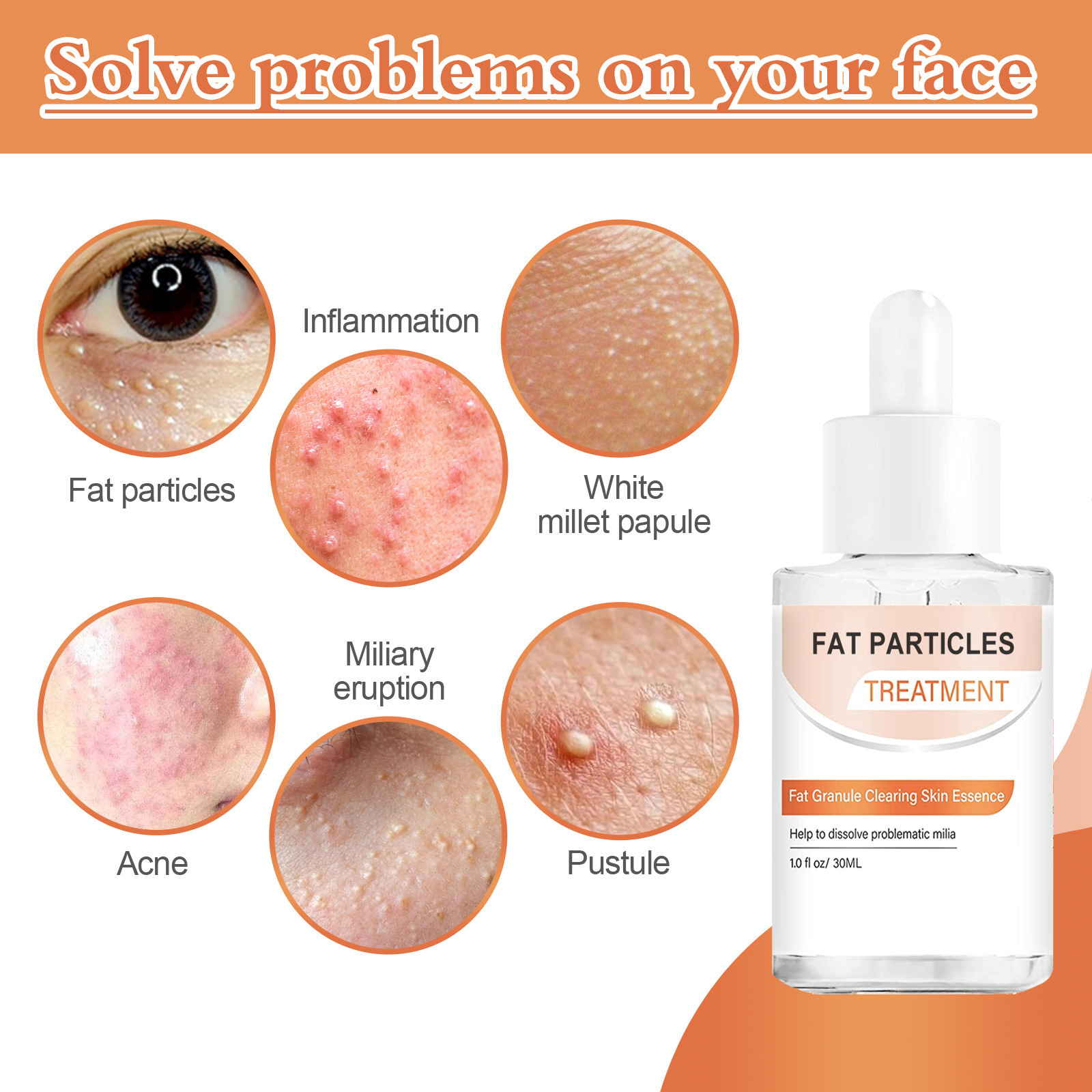 2024 Rimozione e riparazione Riduce l'acne di miglio, ripara la barriera cutanea, l'essenza delicata riparatrice dei pori_voghion.com