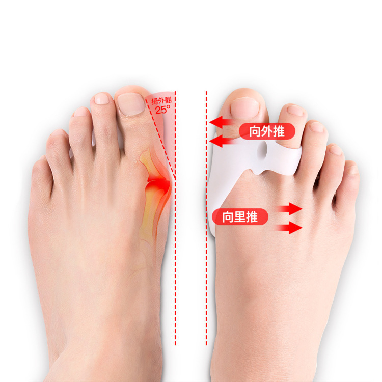 Toe corrector, toe separator, to correct large female toes, wearable shoes, soft rubber thumb valgus artifact, factory direct sale