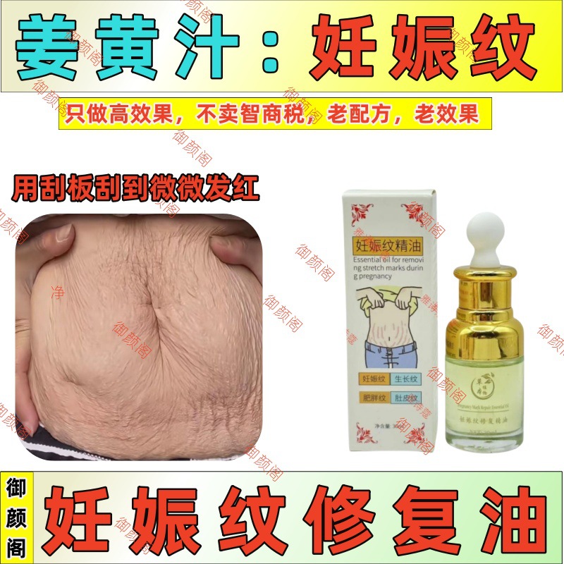 妊娠纹修复精油紧致淡化肥胖纹疤痕膏产后淡化生长纹妊娠纹刮痧油