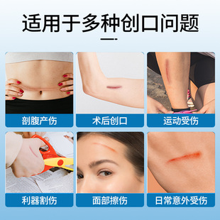 Hongsheng Upgraded Hydrocolloid Wound Tension Reducer Reversible Elastic Bandage Seam-Free Tape Band-Aid Wound Zipper