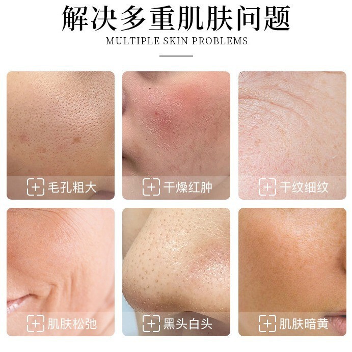 Newface 17-in-1 多機能スキンマネジメントビューティーサロン外国貿易新しい水素と酸素の大きな泡美容器具|undefined