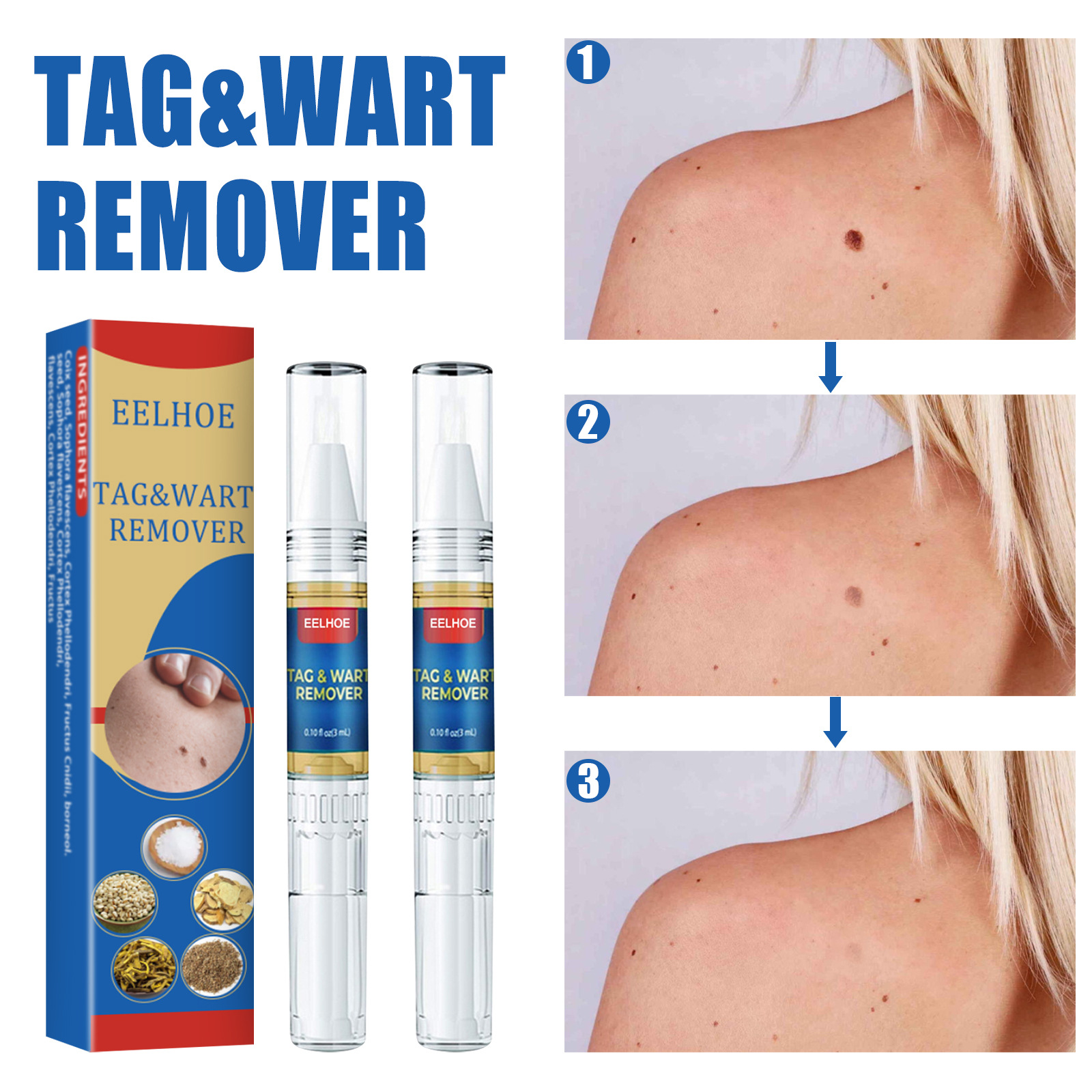 EELHOE Skin Wart Removal Pen and Liquid for Body Skin Tags, Wart Removal, and Skin Repair Treatment Liquid