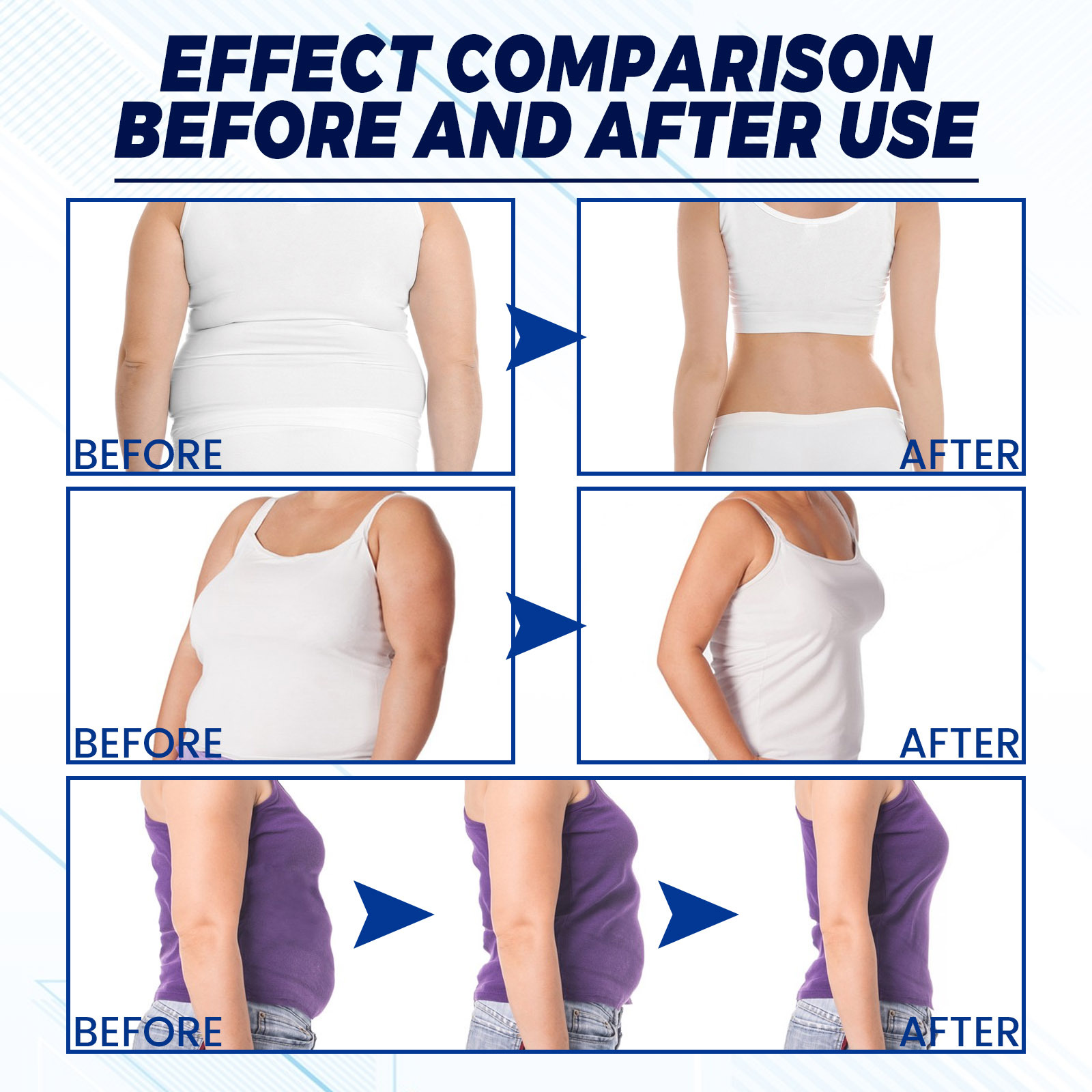 Cryolipolysis Cooler Spray Firming And Skin Shaping Solution_voghion.com