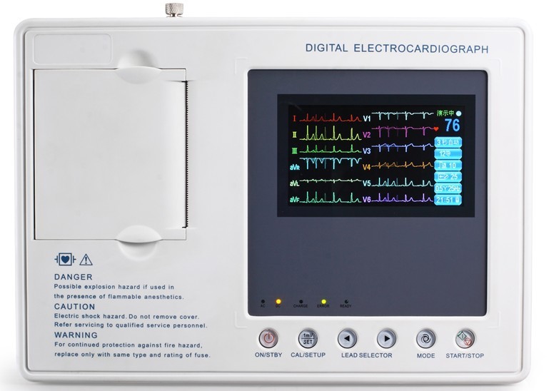 心电图机数字六道12导联同步显示打印心电图机3道心电图机